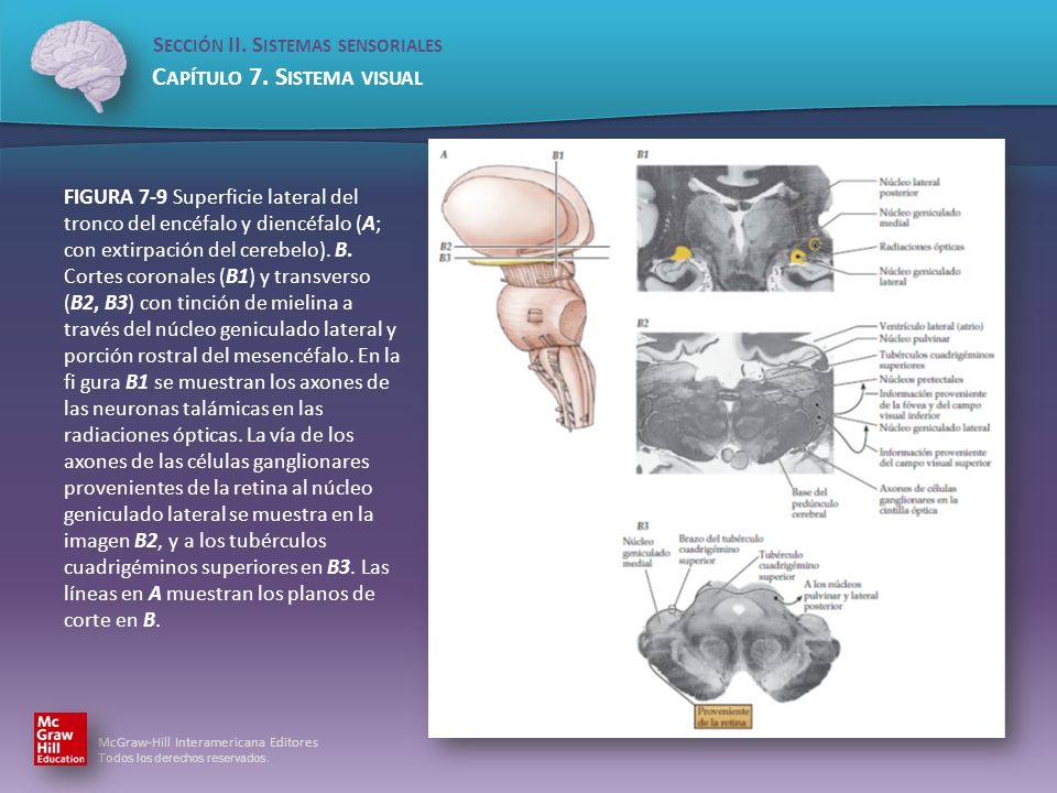 FIGURA 7-9 Superficie lateral del tronco del encéfalo y diencéfalo (A; con extirpación del cerebelo).