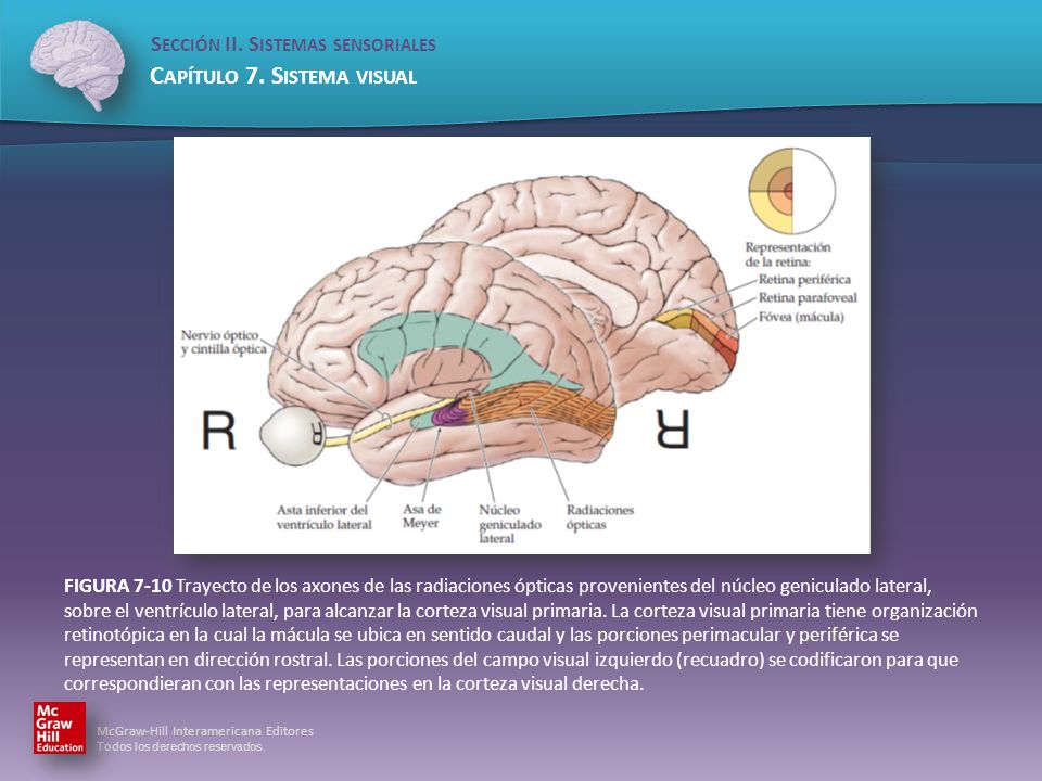 FIGURA 7-10 Trayecto de los axones de las radiaciones ópticas provenientes del núcleo geniculado lateral, sobre el ventrículo lateral, para alcanzar la corteza visual primaria.