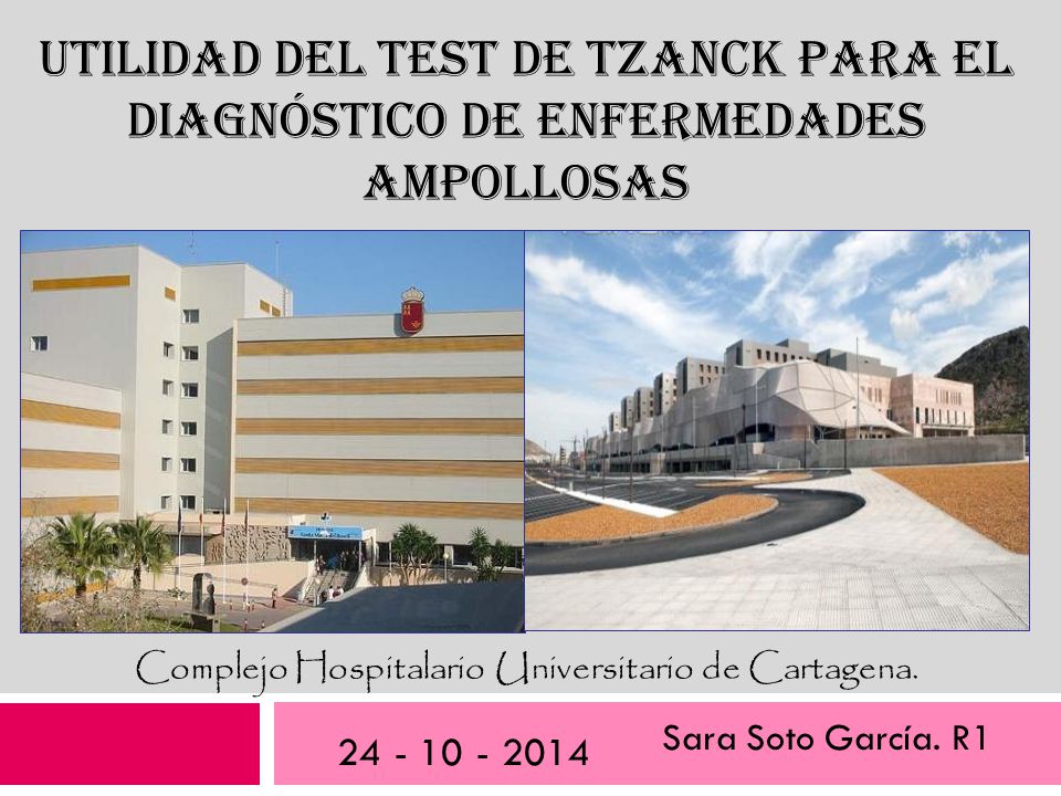 Complejo Hospitalario Universitario de Cartagena.