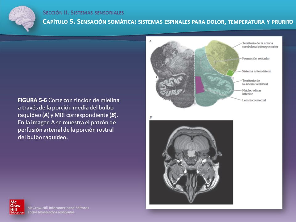 FIGURA 5-6 Corte con tinción de mielina a través de la porción media del bulbo raquídeo (A) y MRI correspondiente (B).