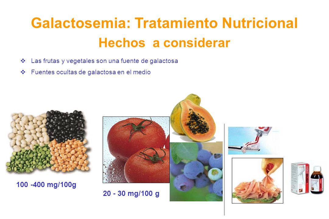Galactosemia: Tratamiento Nutricional Hechos a considerar