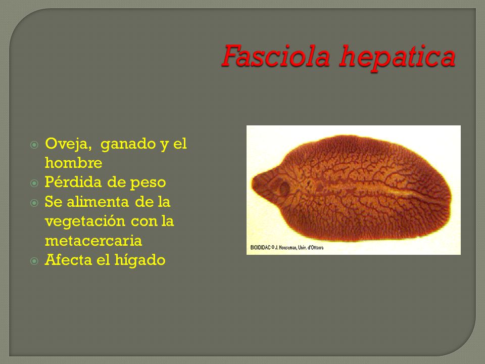 Fasciola hepatica Oveja, ganado y el hombre Pérdida de peso