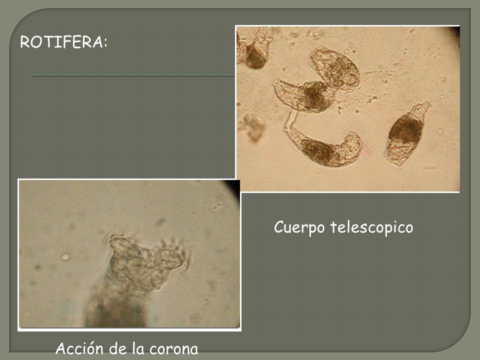 ROTIFERA: Cuerpo telescopico Acción de la corona