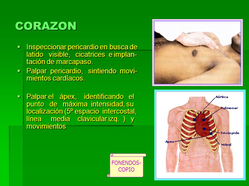 CORAZON Inspeccionar pericardio en busca de latido visible, cicatrices e implan-tación de marcapaso.