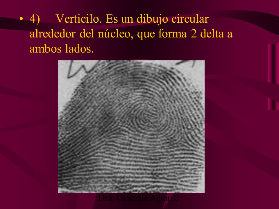 4) Verticilo. Es un dibujo circular alrededor del núcleo, que forma 2 delta a ambos lados.