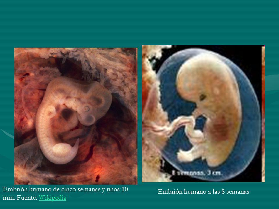 Embrión humano de cinco semanas y unos 10 mm. Fuente: Wikipedia