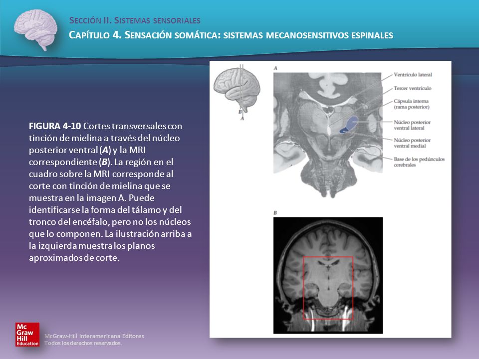 FIGURA 4-10 Cortes transversales con tinción de mielina a través del núcleo posterior ventral (A) y la MRI correspondiente (B).