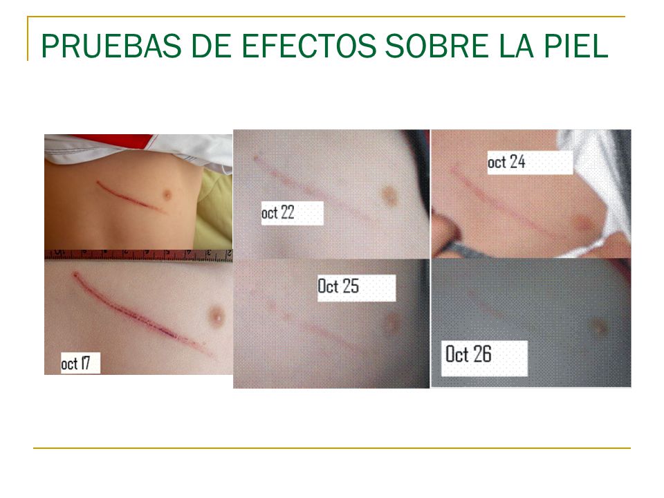 PRUEBAS DE EFECTOS SOBRE LA PIEL
