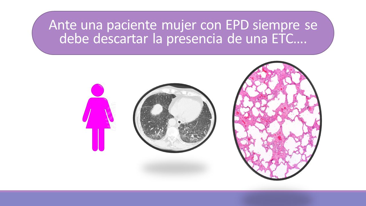 Ante una paciente mujer con EPD siempre se debe descartar la presencia de una ETC….