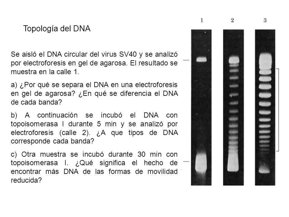 Topología del DNA Se aisló el DNA circular del virus SV40 y se analizó por electroforesis en gel de agarosa. El resultado se muestra en la calle 1.