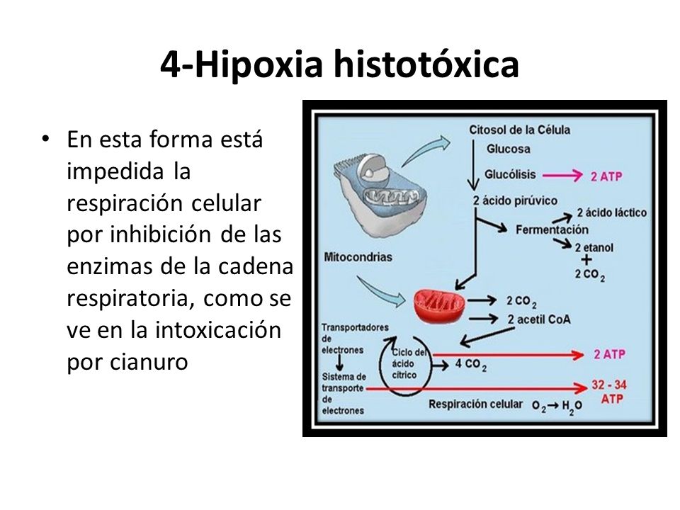 4-Hipoxia histotóxica