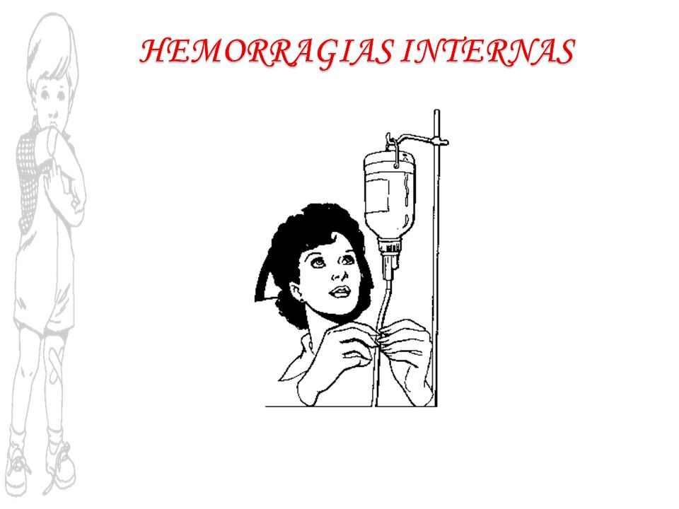 HEMORRAGIAS INTERNAS