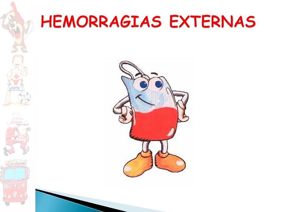 HEMORRAGIAS EXTERNAS