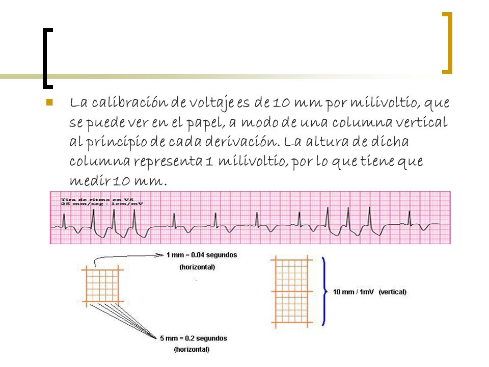 La calibración de voltaje es de 10 mm por milivoltio, que se puede ver en el papel, a modo de una columna vertical al principio de cada derivación.