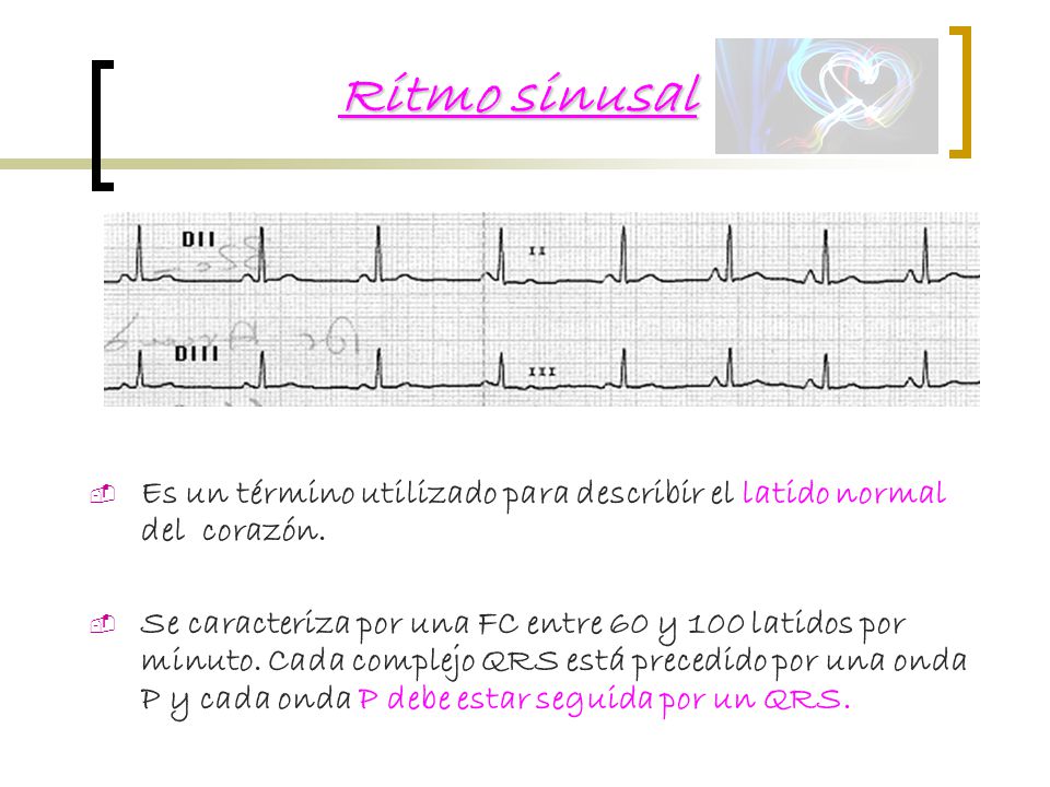 Ritmo sinusal Es un término utilizado para describir el latido normal del corazón.