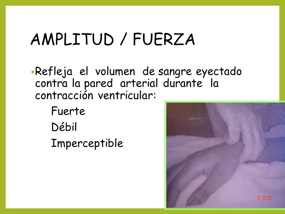AMPLITUD / FUERZA Refleja el volumen de sangre eyectado contra la pared arterial durante la contracción ventricular: