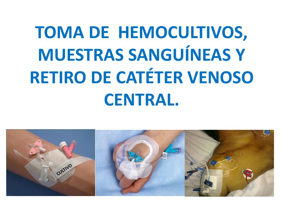 TOMA DE HEMOCULTIVOS, MUESTRAS SANGUÍNEAS Y RETIRO DE CATÉTER VENOSO CENTRAL.