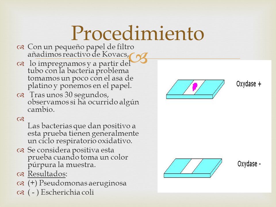 Procedimiento Con un pequeño papel de filtro añadimos reactivo de Kovacs,