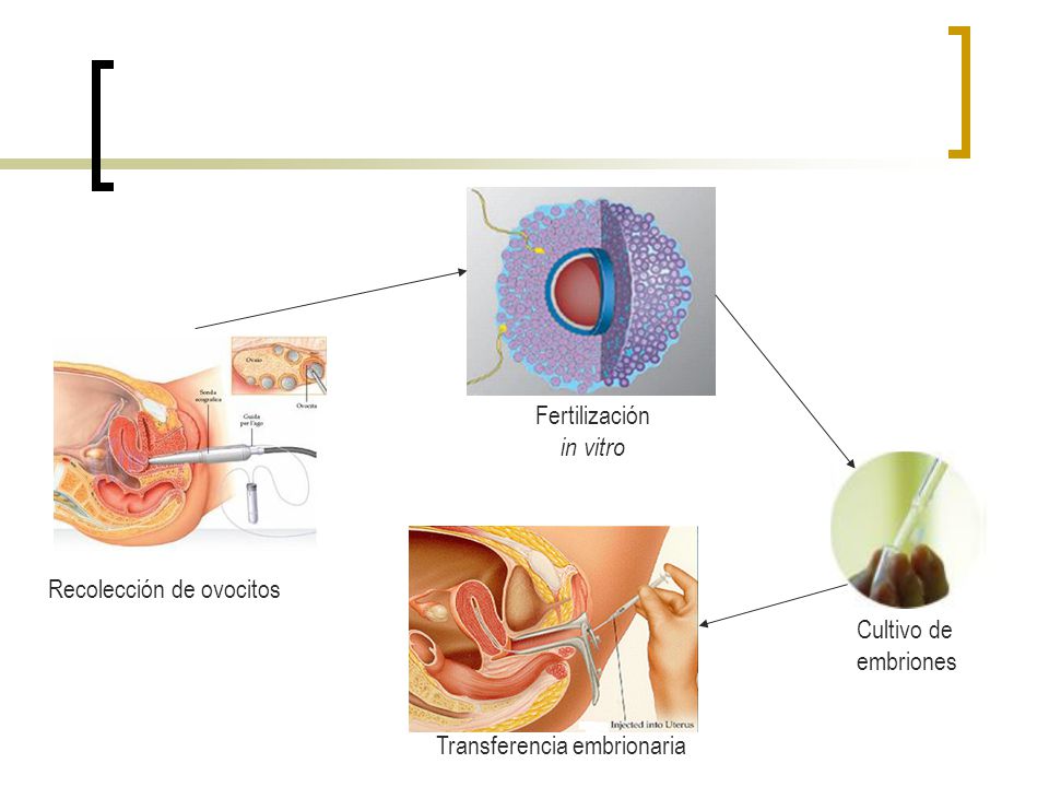 Fertilización in vitro Recolección de ovocitos Cultivo de embriones Transferencia embrionaria