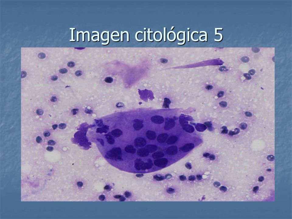 Imagen citológica 5