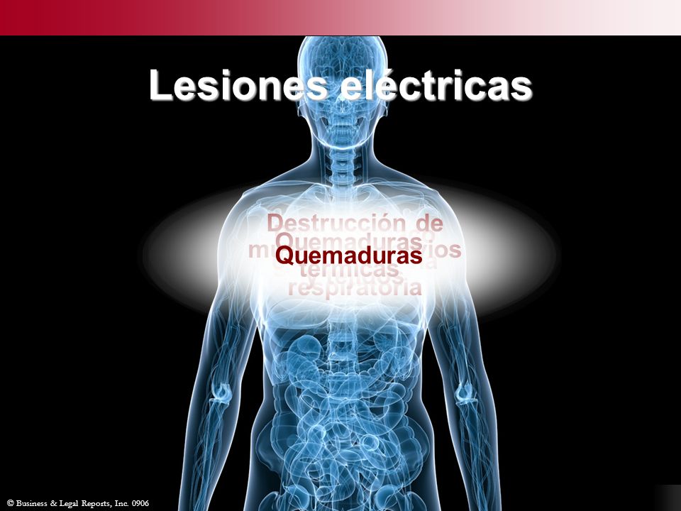 Lesiones eléctricas Destrucción de músculos, nervios y tejidos