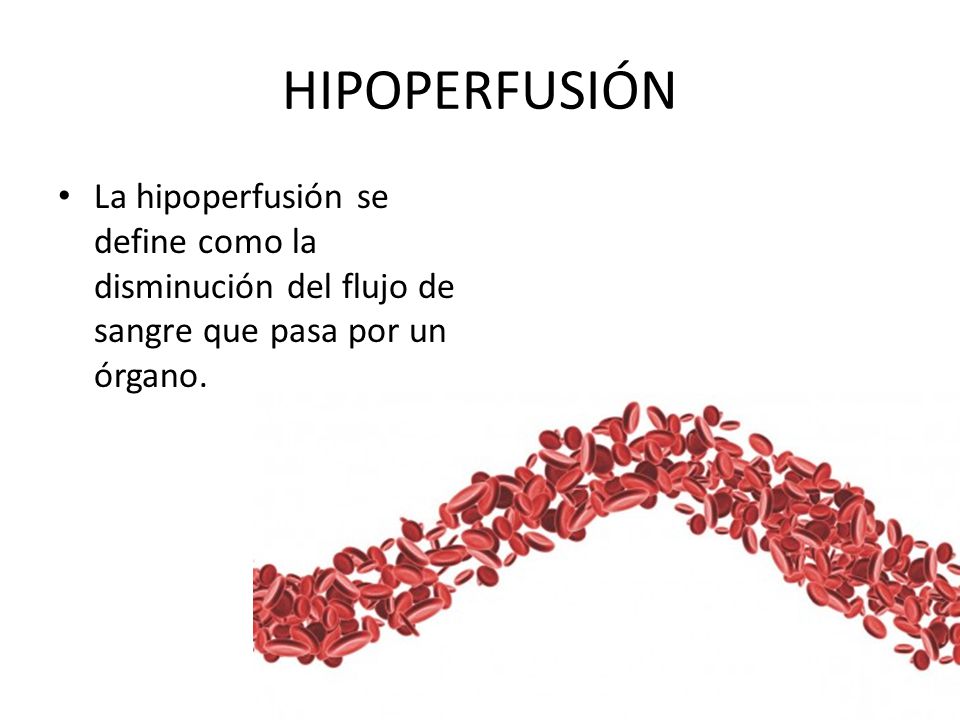 HIPOPERFUSIÓN La hipoperfusión se define como la disminución del flujo de sangre que pasa por un órgano.