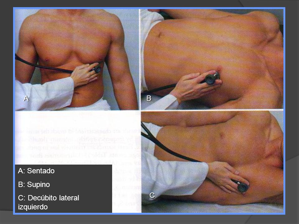 A: Sentado B: Supino C: Decúbito lateral izquierdo A B C