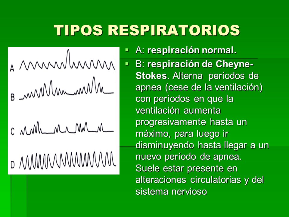 TIPOS RESPIRATORIOS A: respiración normal.