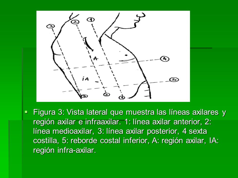 Figura 3: Vista lateral que muestra las líneas axilares y región axilar e infraaxilar.