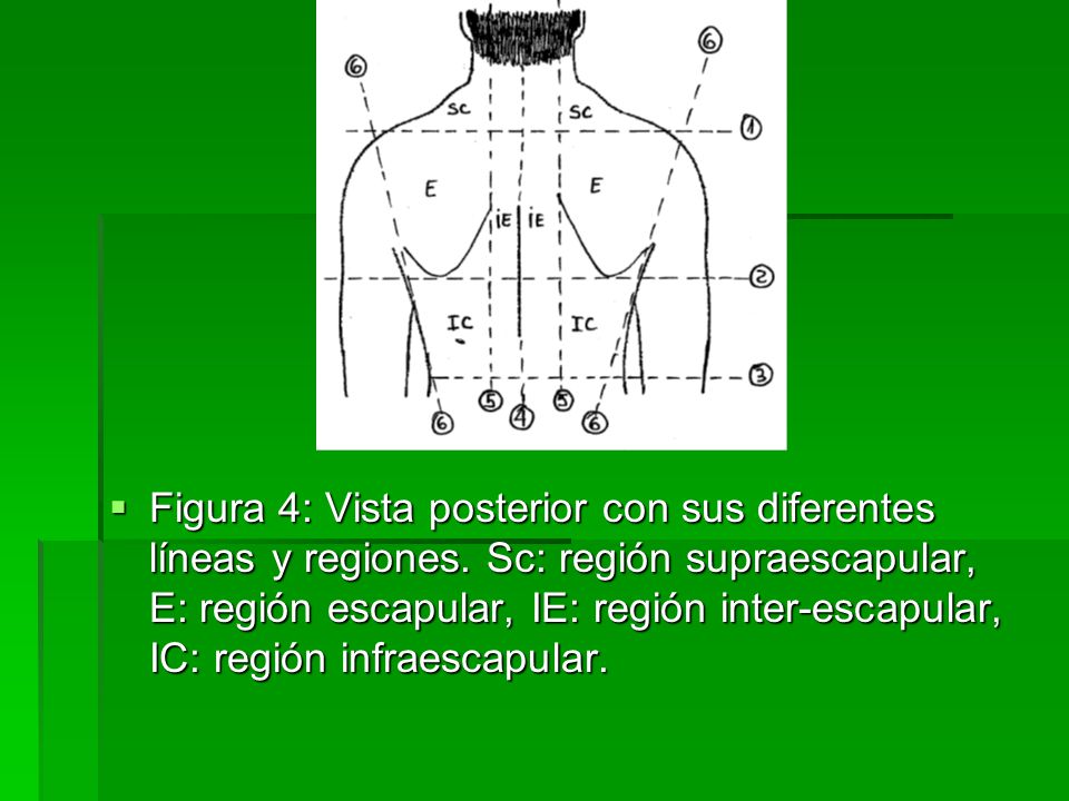 Figura 4: Vista posterior con sus diferentes líneas y regiones
