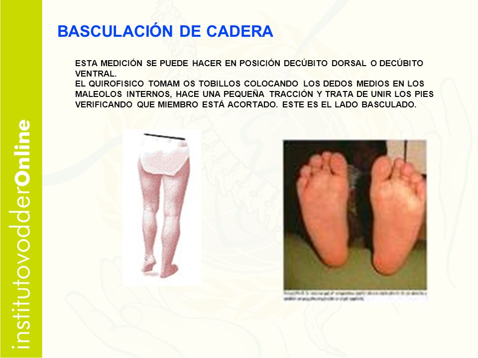BASCULACIÓN DE CADERA ESTA MEDICIÓN SE PUEDE HACER EN POSICIÓN DECÚBITO DORSAL O DECÚBITO VENTRAL.