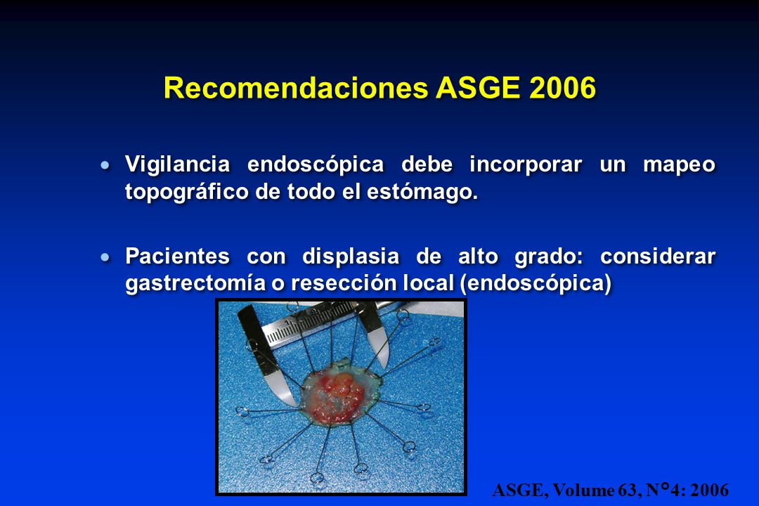 Recomendaciones ASGE 2006 Vigilancia endoscópica debe incorporar un mapeo topográfico de todo el estómago.