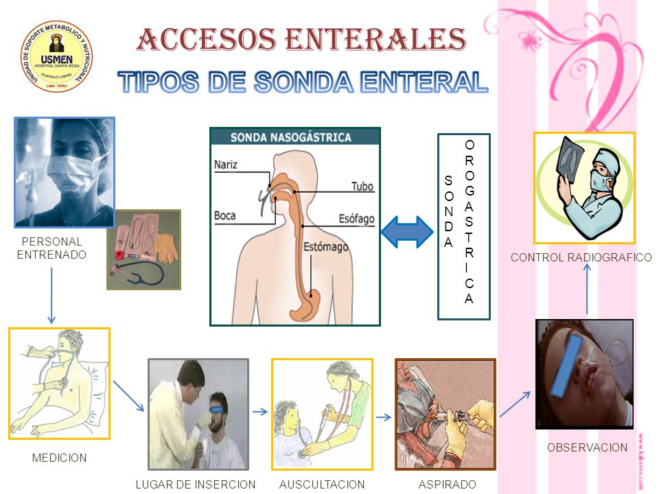 ACCESOS ENTERALES TIPOS DE SONDA ENTERAL O R G A S S O T N D I A C