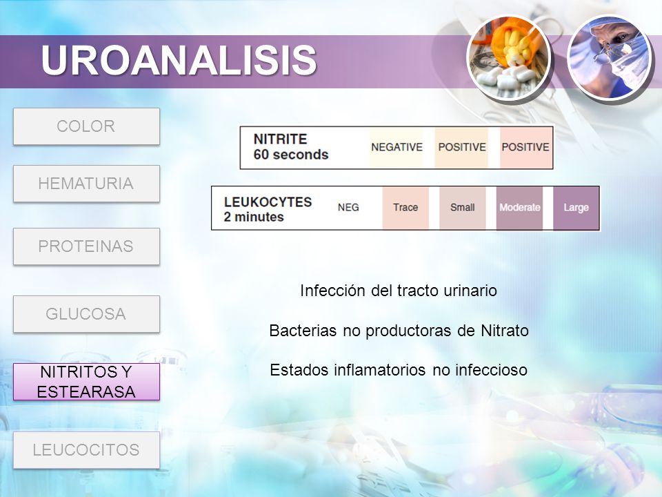 UROANALISIS COLOR HEMATURIA PROTEINAS Infección del tracto urinario