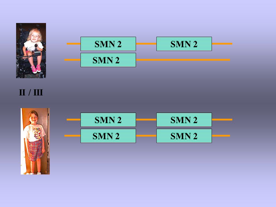 SMN 2 SMN 2 SMN 2 II / III SMN 2 SMN 2 SMN 2 SMN 2