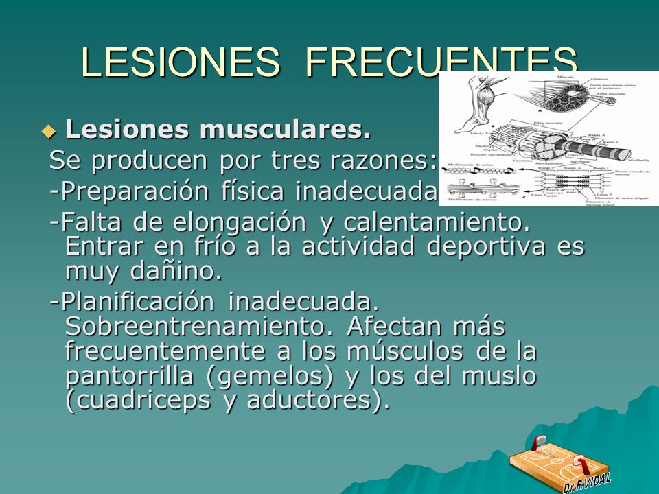 LESIONES FRECUENTES Lesiones musculares. Se producen por tres razones: