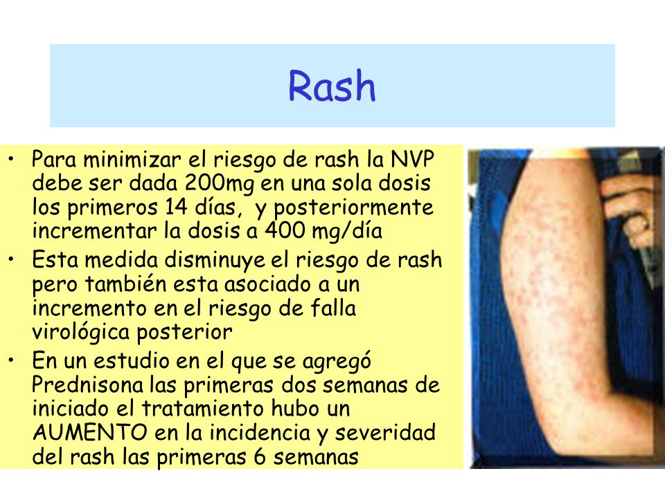 Rash