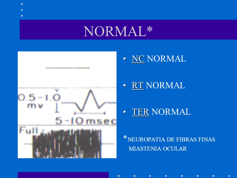 NORMAL* NC NORMAL RT NORMAL TER NORMAL *NEUROPATIA DE FIBRAS FINAS