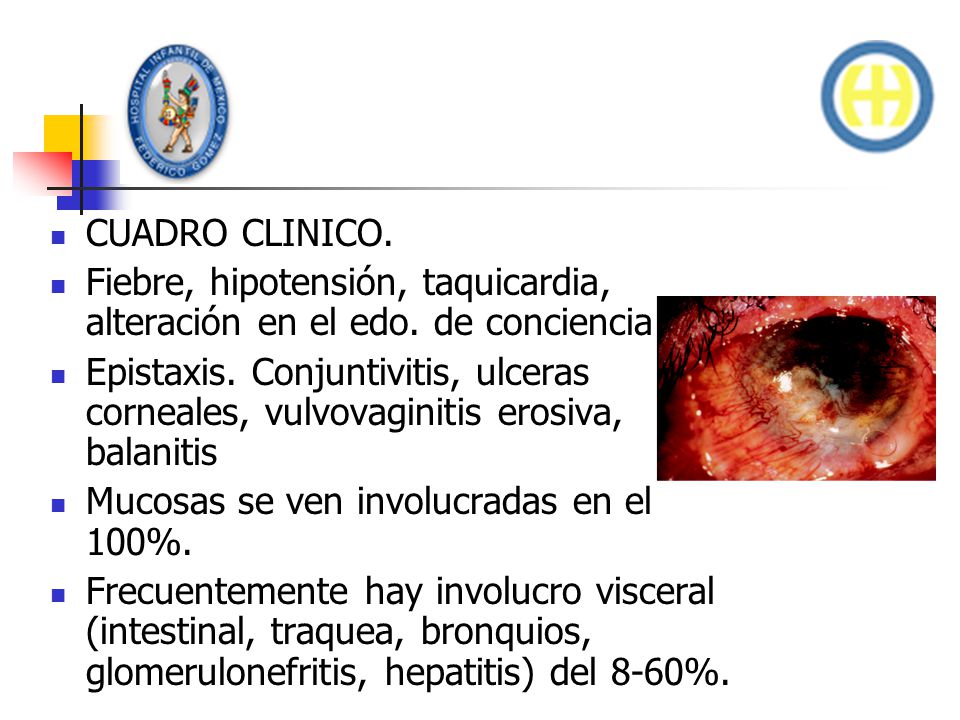 CUADRO CLINICO. Fiebre, hipotensión, taquicardia, alteración en el edo. de conciencia.