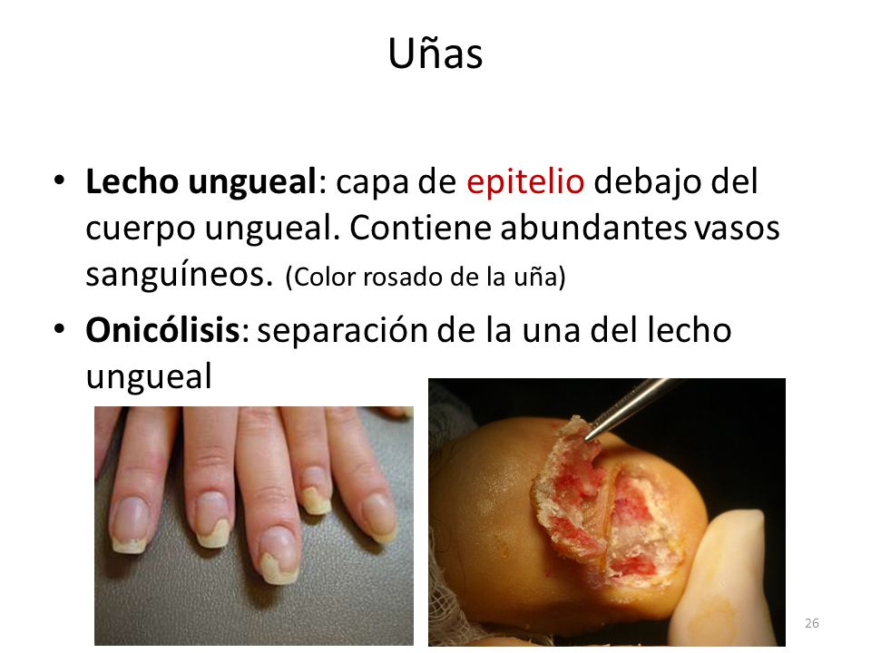 Uñas Lecho ungueal: capa de epitelio debajo del cuerpo ungueal. Contiene abundantes vasos sanguíneos. (Color rosado de la uña)