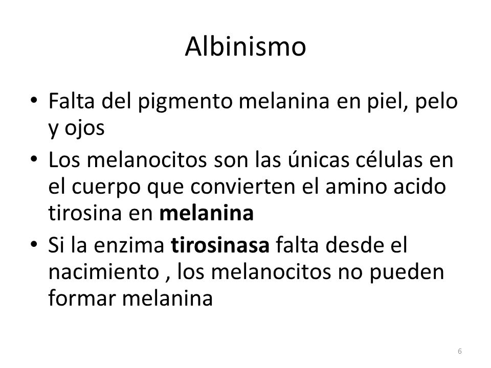 Albinismo Falta del pigmento melanina en piel, pelo y ojos