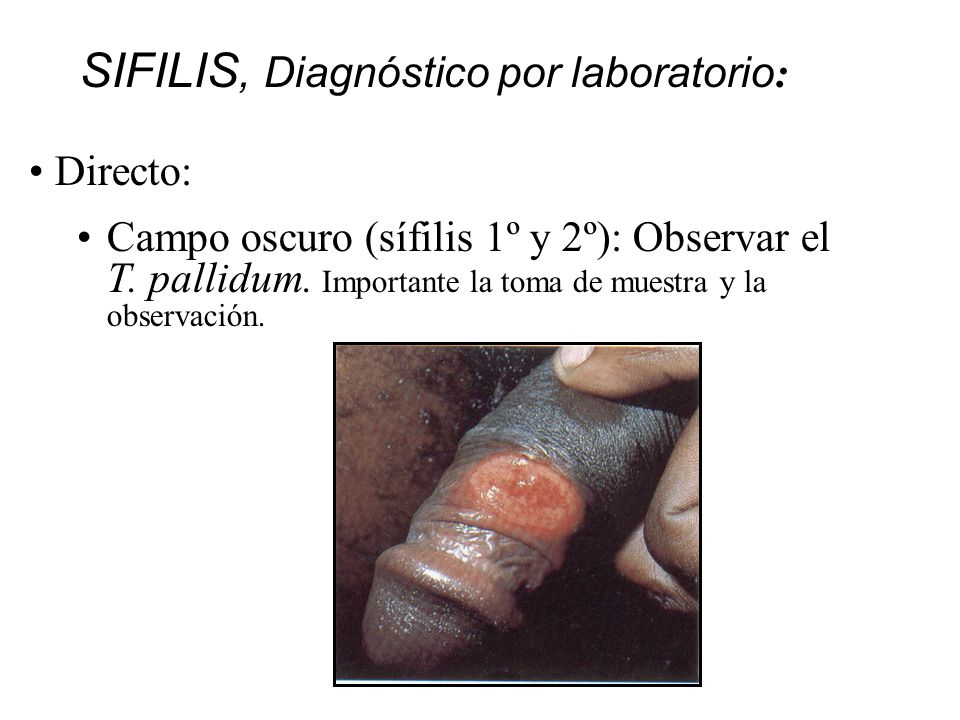 SIFILIS, Diagnóstico por laboratorio: