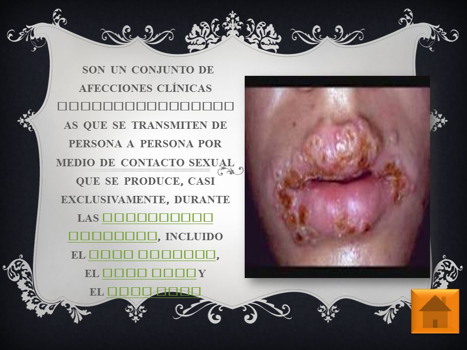 Emfermedades del sexo anal pics 898