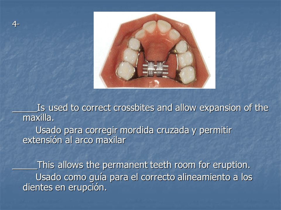 _____Is used to correct crossbites and allow expansion of the maxilla.