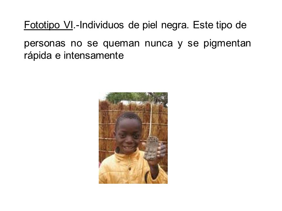 Fototipo VI.-Individuos de piel negra. Este tipo de
