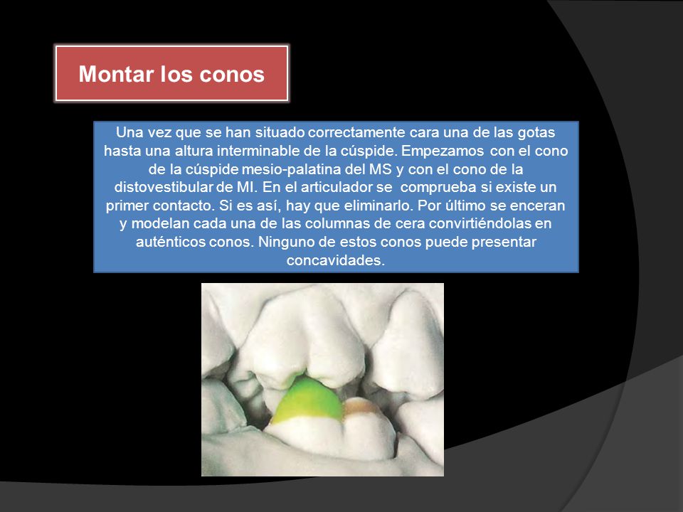 Montar los conos