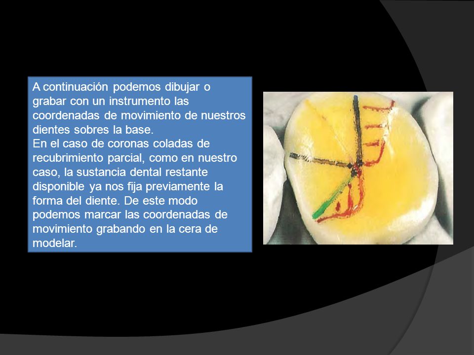 A continuación podemos dibujar o grabar con un instrumento las coordenadas de movimiento de nuestros dientes sobres la base.