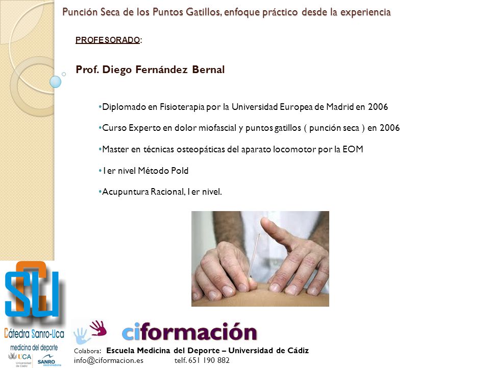 Punción Seca de los Puntos Gatillos, enfoque práctico desde la experiencia
