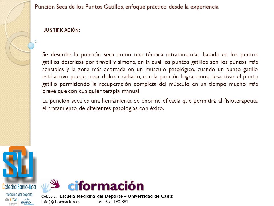 Punción Seca de los Puntos Gatillos, enfoque práctico desde la experiencia