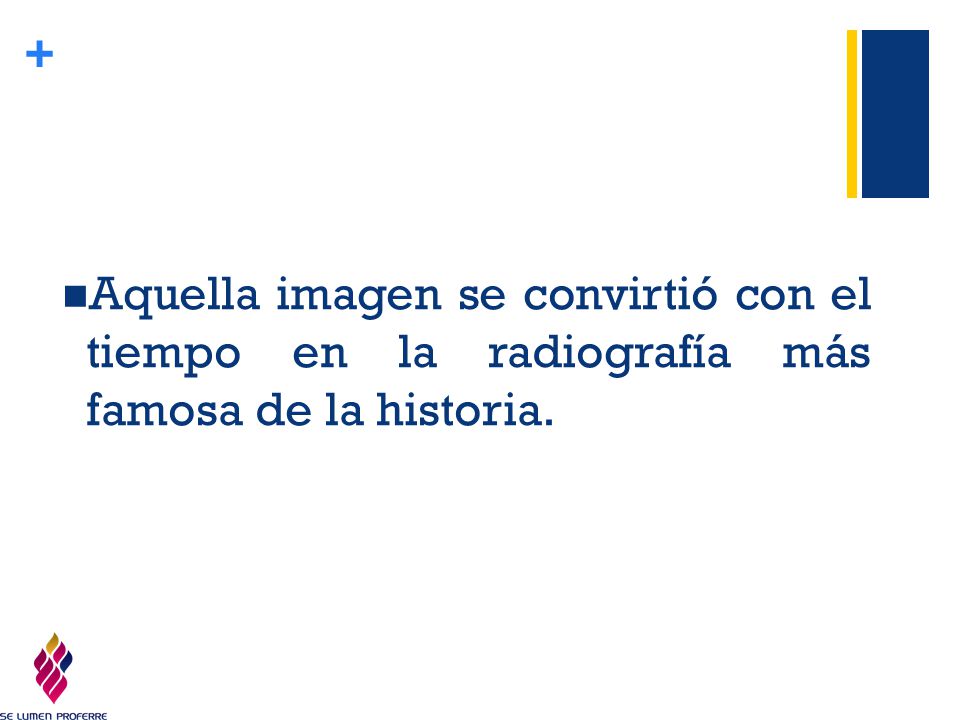 Aquella imagen se convirtió con el tiempo en la radiografía más famosa de la historia.